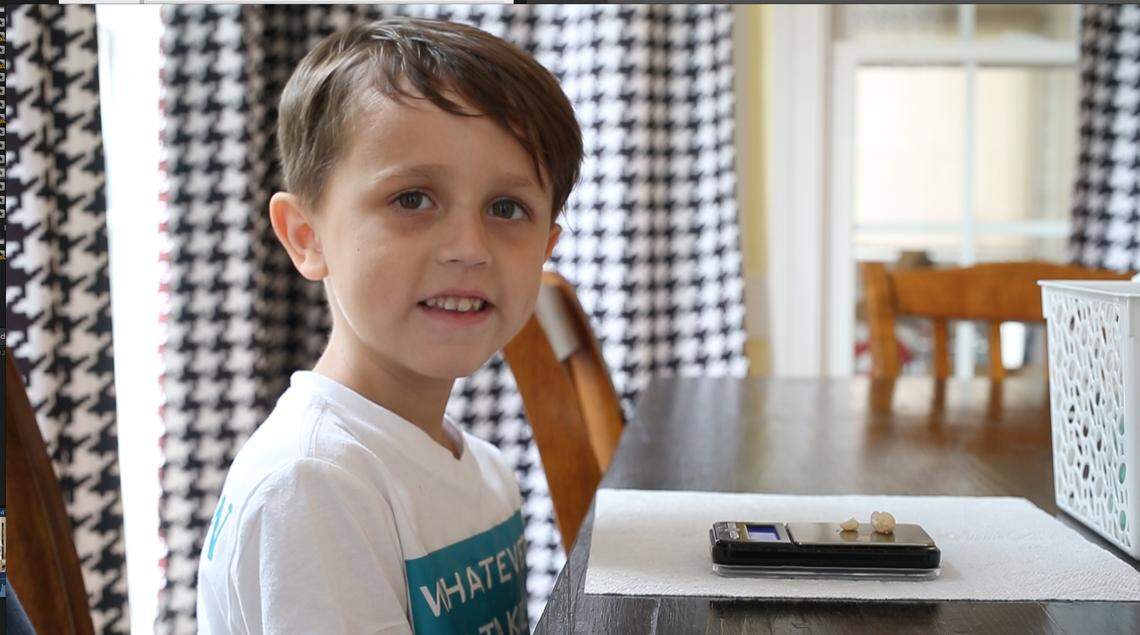 Six-year-old Elias Kroboth of Raleigh has an extreme allergy to peanuts.