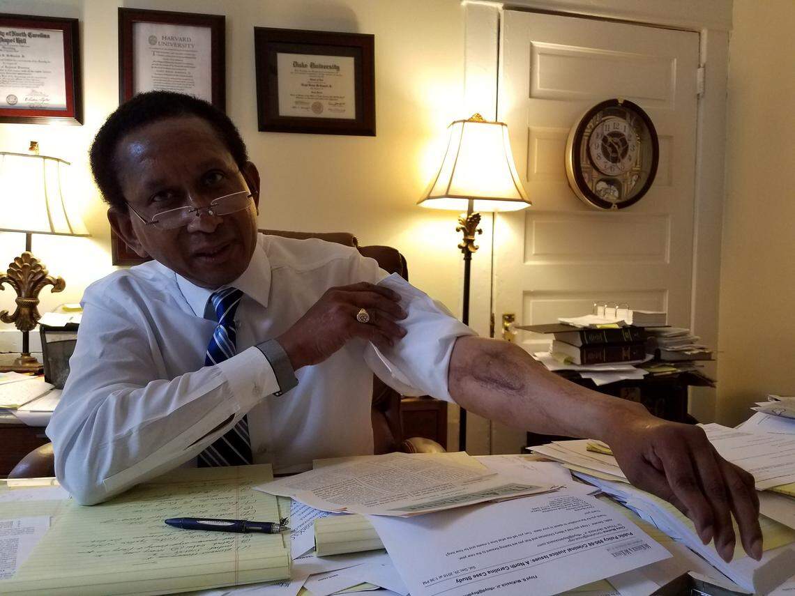 N.C. Sen. Floyd McKissick Jr. (D-Durham) shows the scar he has from being shot with a shotgun during an armed robbery in 1985, exactly half his life ago.