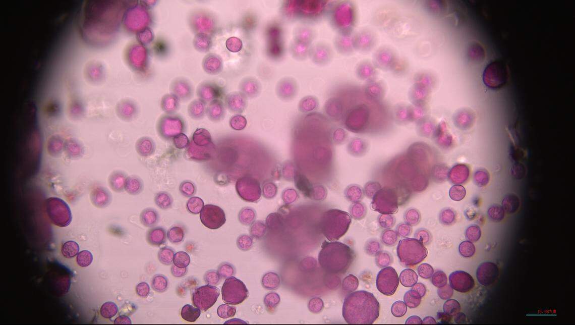 Pollen under the microscope on a “very high” pollen count day from April 2024. The pollen was collected and the pollen grains were counted by the state’s pollen sample collector.