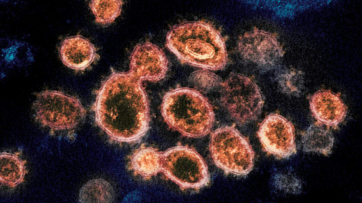 This 2020 electron microscope image provided by the National Institute of Allergy and Infectious Diseases - Rocky Mountain Laboratories shows SARS-CoV-2 virus particles which cause COVID-19, isolated from a patient in the U.S., emerging from the surface of cells cultured in a lab. Viruses are constantly mutating, with coronavirus variants circulating around the globe.