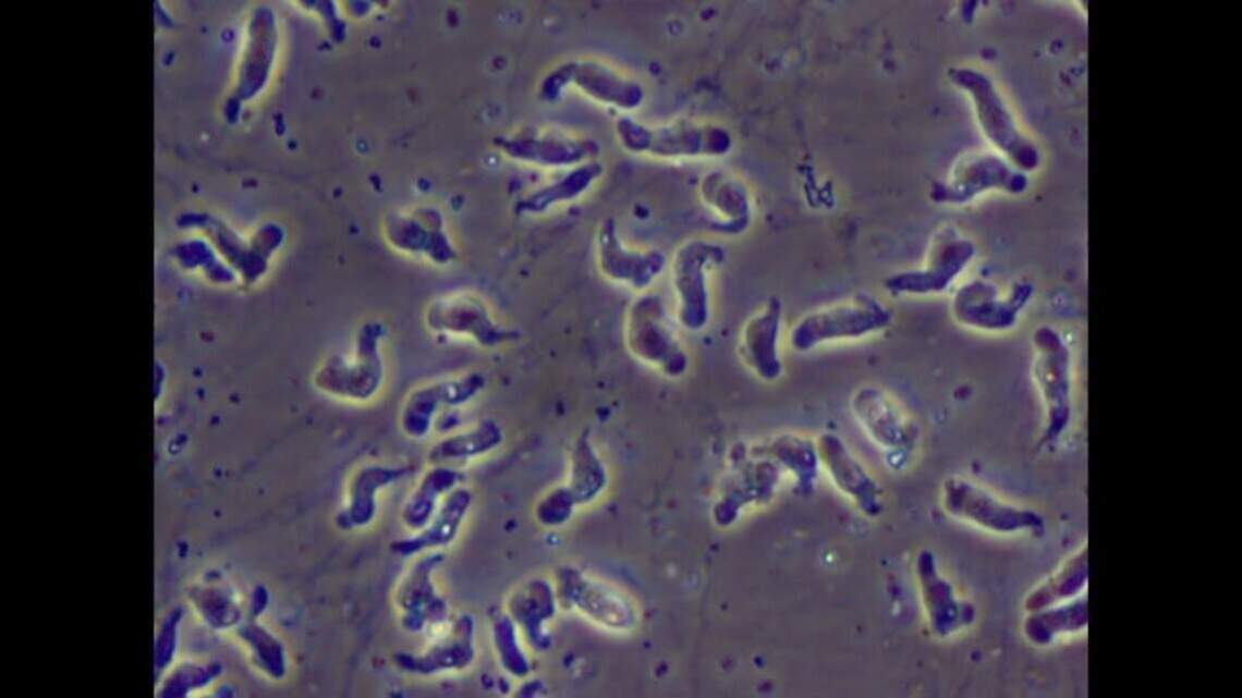 Central NC family starts fundraiser for teen hospitalized with brain-eating amoeba