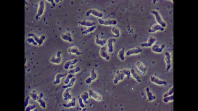 Central NC family starts fundraiser for teen hospitalized with brain-eating amoeba