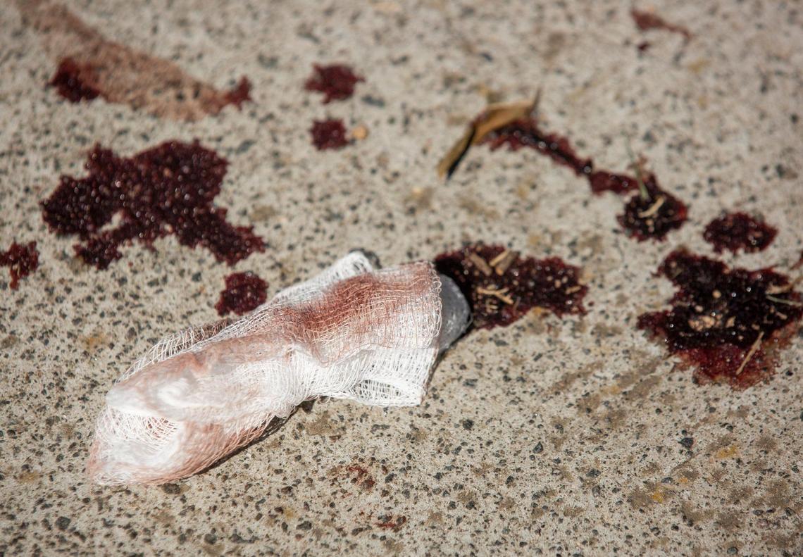 Blood stains remain the morning after on the sidewalk where police say five people were injured and one person was killed in a shooting at McDougald Terrace, and on nearby Linwood Avenue, on Thursday, Aug. 19, 2021, in Durham, N.C.