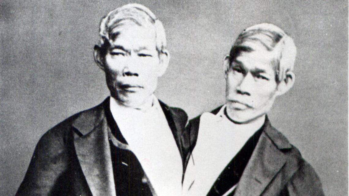 The original Siamese twins, who settled in NC, were far more than a freak show