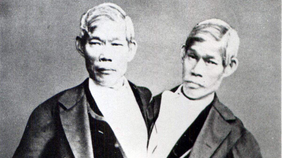 The lives of Siamese twins Chang and Eng Bunker are reexamined in "Inseparable," a new biography that considers their "otherness" through both unusual biology and race.