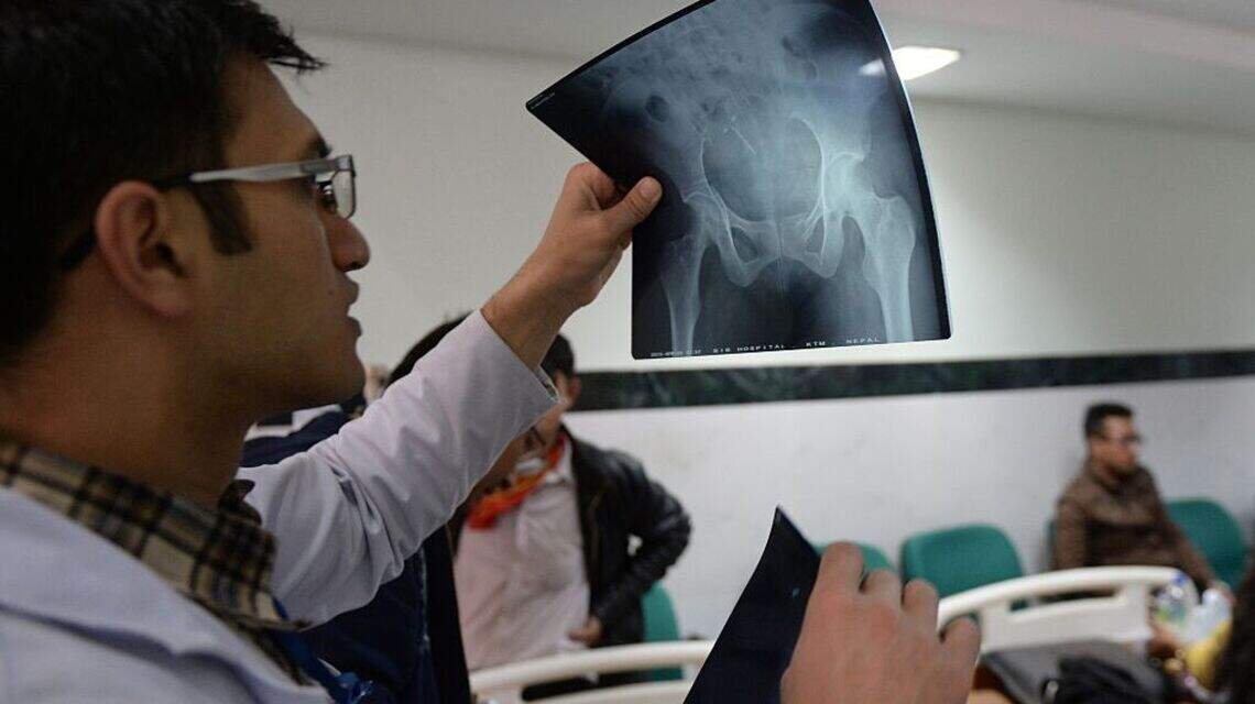 Researchers Found a Hidden Receptor Can Rebuild Bone and Most Doctors Have Never Heard of It