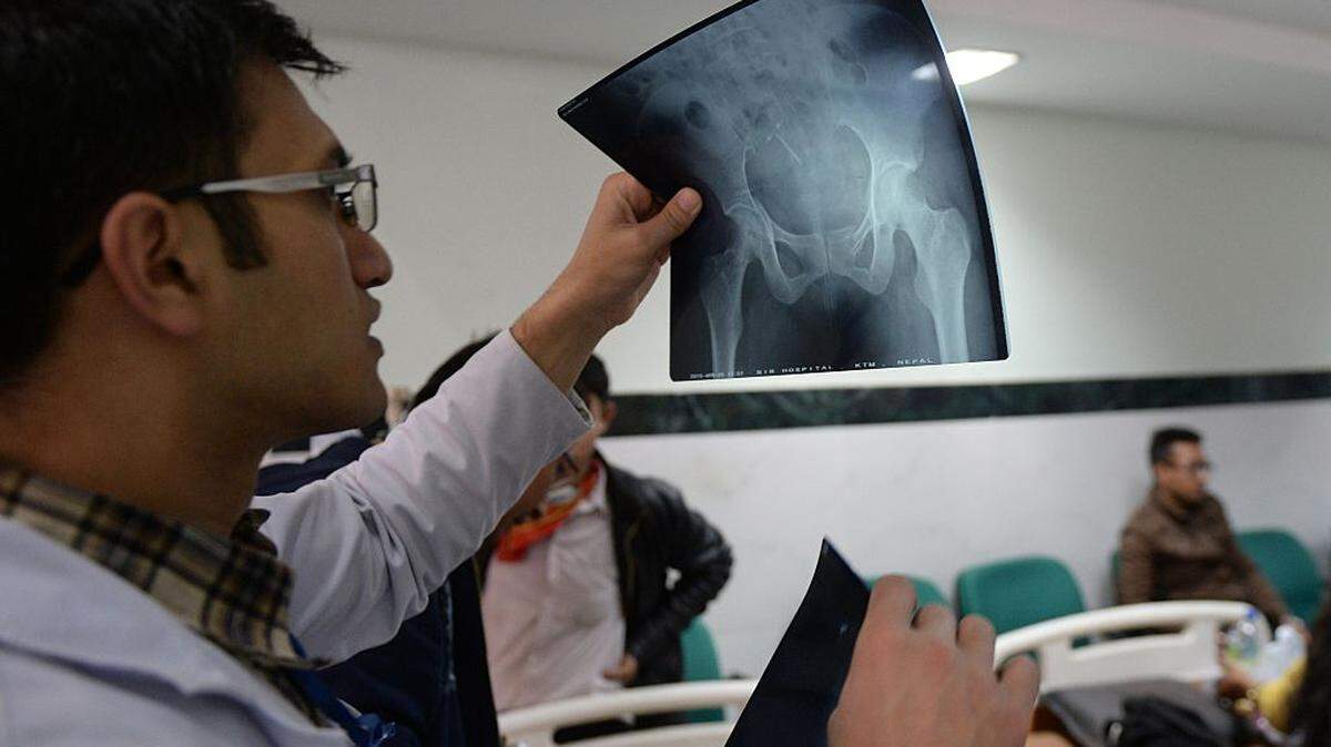 Scientists found a hidden receptor that stops bone loss and may rebuild what you already lost. Here is what the research shows.