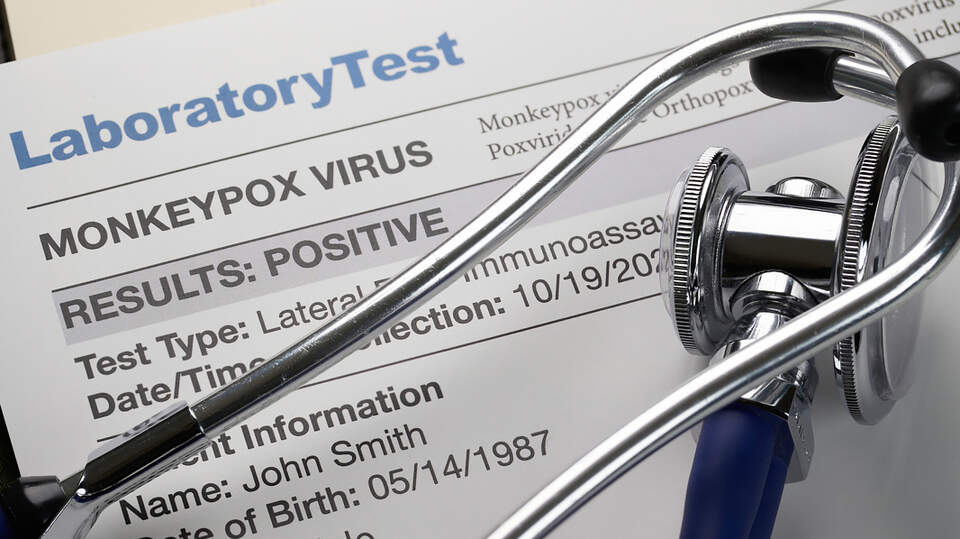 Lyn Riddle Mpox virus in South Carolina, here’s what to know | The State