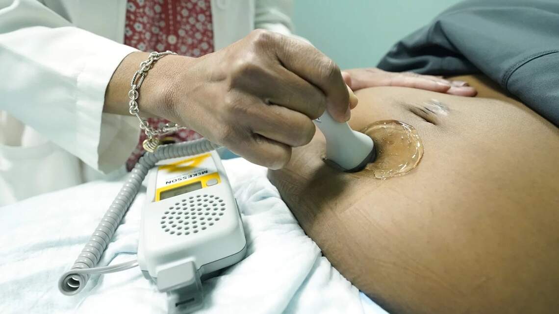 Two changes will help NC’s maternal health, but abortion limits are a setback | Opinion