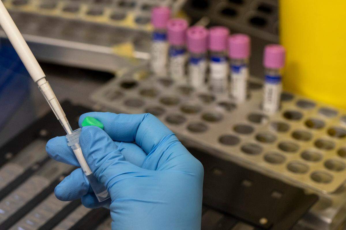 A medical laboratory technician inactivates suspected monkeypox samples to be PCR tested.