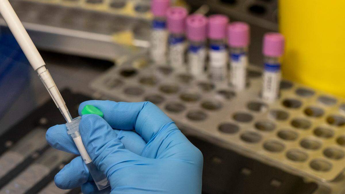 A medical laboratory technician inactivates suspected monkeypox samples to be PCR tested.