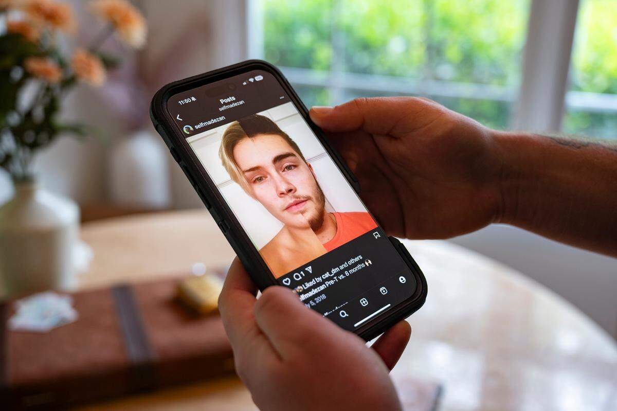 Zan documented his journey and transition on social media, excited to share the changes he was going through. He looked to others on social media who had similar experiences to help him feel less alone. Now he is more reserved when it comes to posting, hesitant about the backlash that could occur from talking about his trans identity.