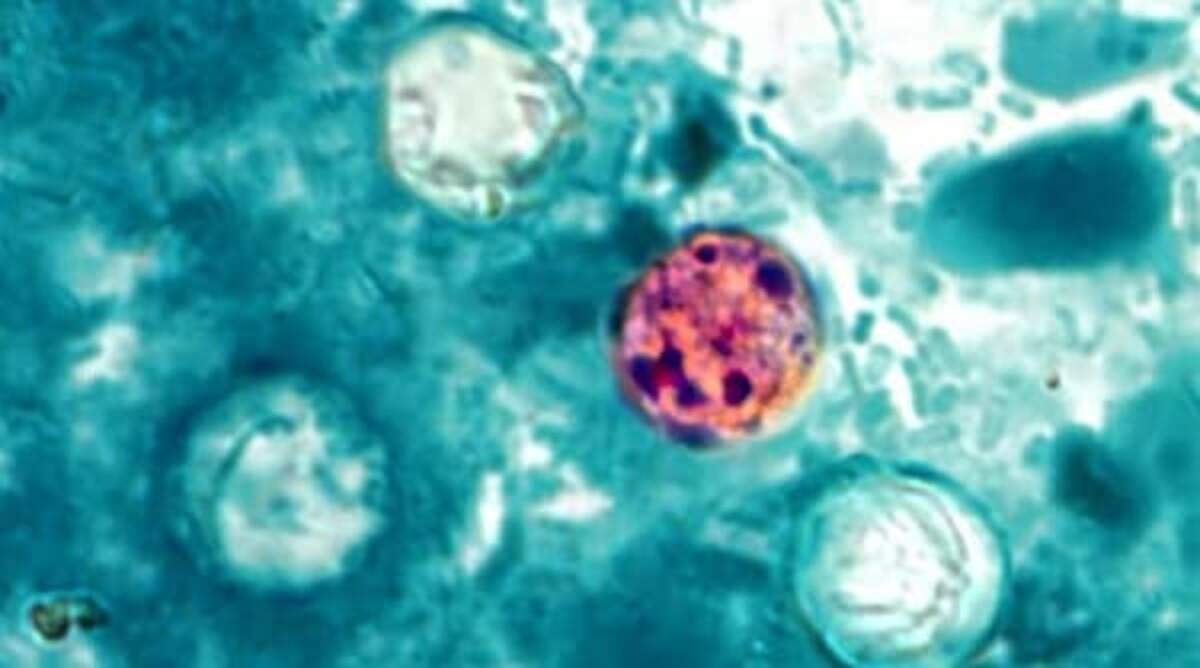 A microspopic views of Cyclospora cayetanensis in a sample. The unicellular parasite causes an intestinal infection called cyclosporiasis.