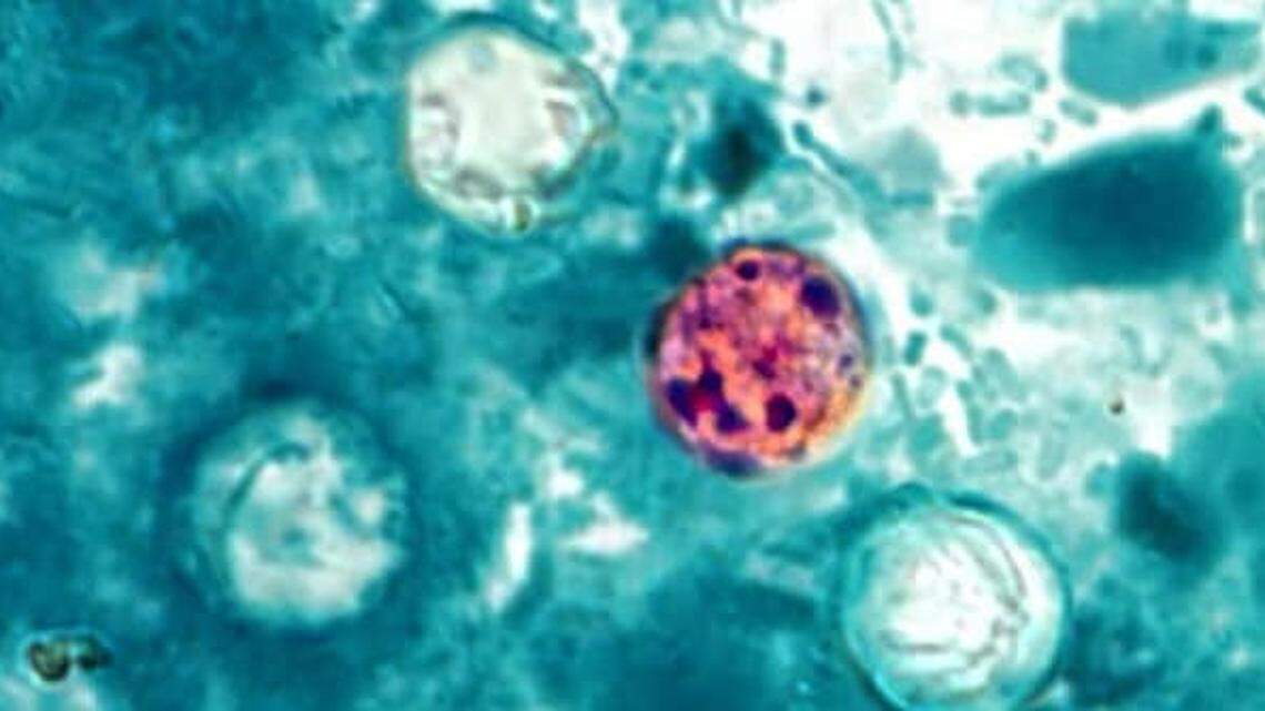 A microscopic view of Cyclospora cayetanensis in a sample.