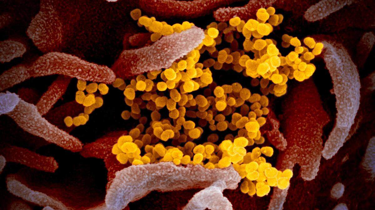 This scanning electron microscope image shows SARS-CoV-2 (yellow)—also known as 2019-nCoV, the virus that causes COVID-19—isolated from a patient in the U.S., emerging from the surface of cells (pink) cultured in the lab.