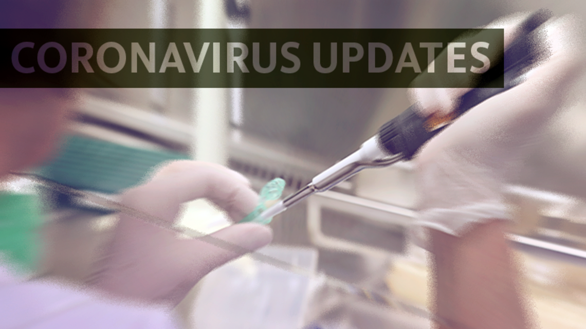 1,000 NC patients will get an antibody test to see if they’ve had coronavirus