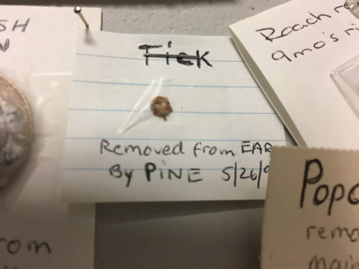 This tick was taken from a UNC patient's ear in 1999, one in an extensive collection of foreign objects retrieved from ears, noses and throats.