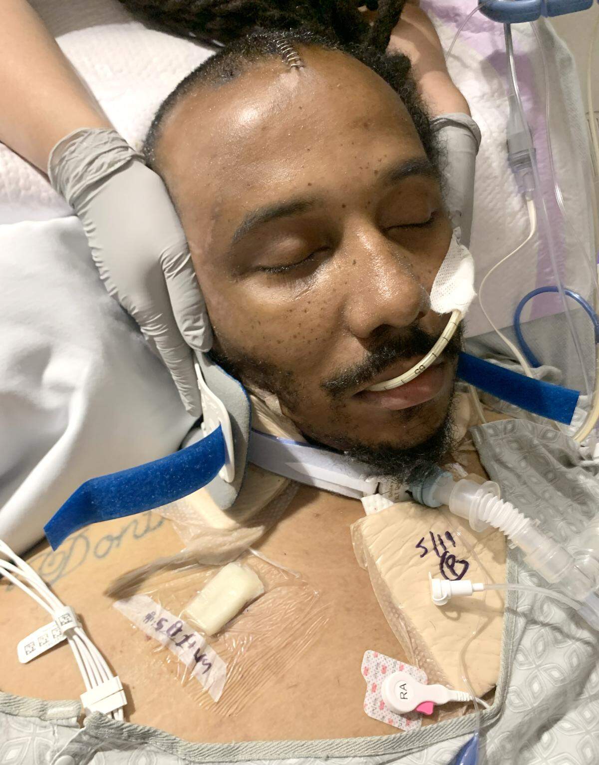 Anthony Chase in the hospital after a May 2024 wreck where he was hit by a drunk driver.