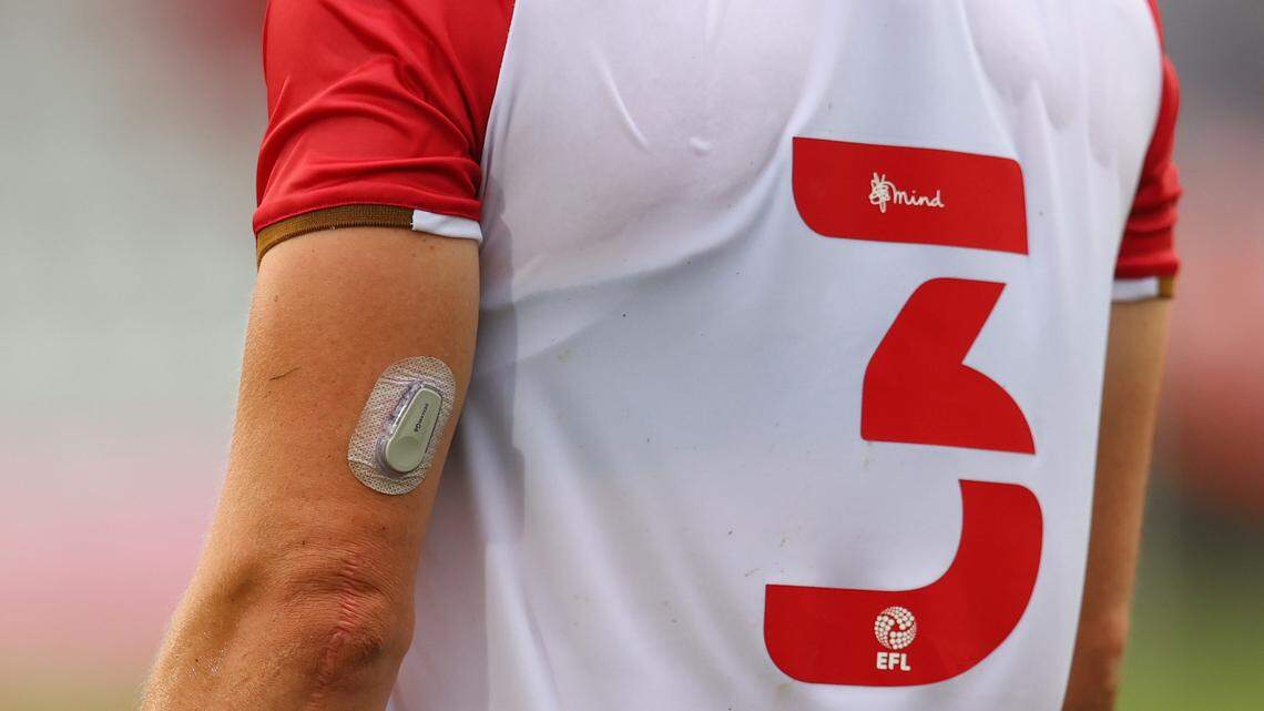 CGM Application, Placement and Adhesion Troubleshooting to Make Sure You Have a Secure Fit