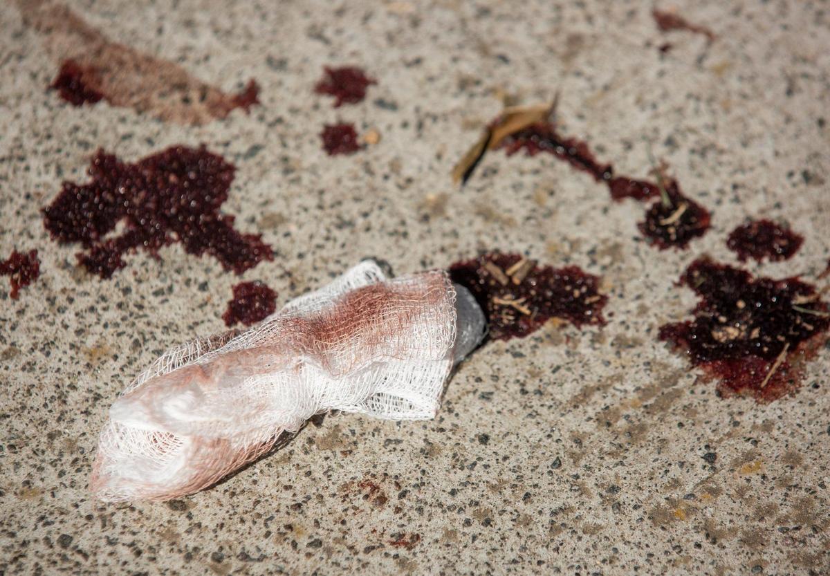 Blood stains remain on the sidewalk Aug. 19 after police say four people were injured and one person was killed in a shooting incident at the McDougald Terrace community in Durham. Some residents said they had difficulty reaching 911 to report the shootings.