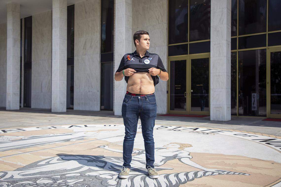 Drew Pescaro, a survivor of the mass shooting at UNC Charlotte in April, stands for a portrait outside the North Carolina Legislative Building displaying his scar left by multiple surgeries for injuries caused by a bullet that entered his back one inch away from his spine, after speaking during a press conference with legislators on Tuesday, Aug. 6, 2019, in Raleigh, NC. NC House Democrats announced they are working to move two gun reform bills to a floor vote.