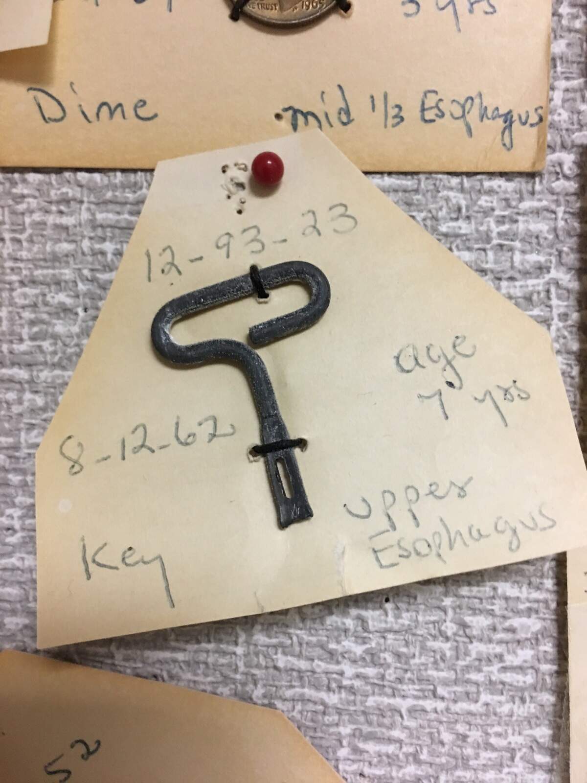 A key for opening a sardine can swallowed by an infant in 1962, part of an exhibit of extracted foreign objects kept at UNC Hospitals in Chapel Hill.
