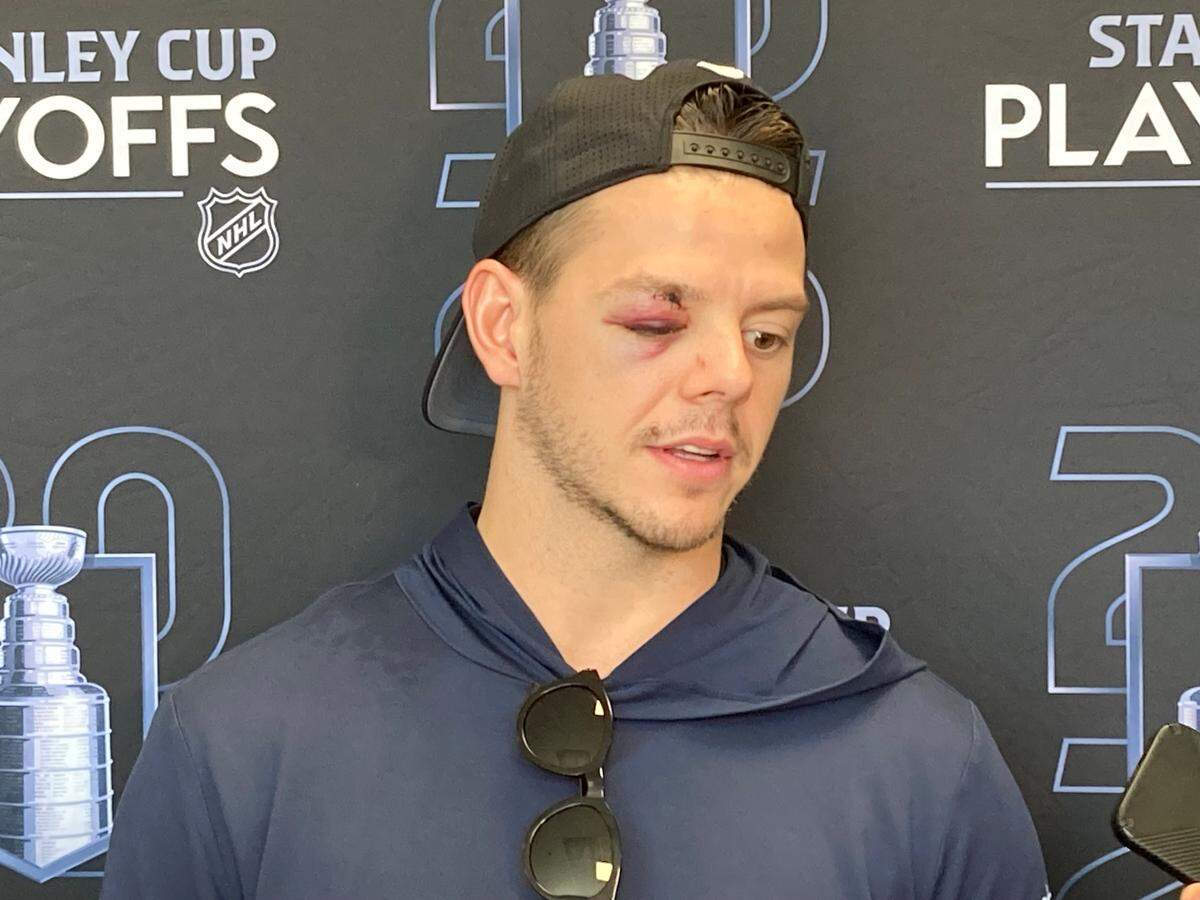 Carolina Hurricanes player Jesperi Kotkaniemi talks to the media on May 1, 2025, two days after he was hit in the eye by a New Jersey Devils’ player’s stick during their NHL playoff game.