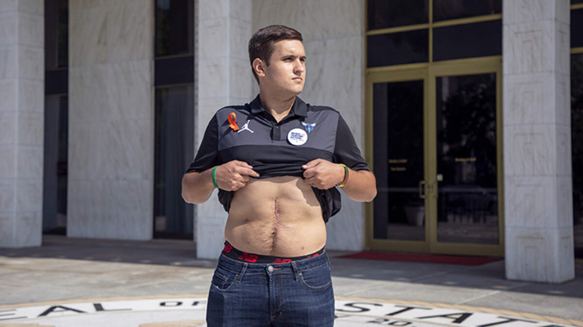 Drew Pescaro, a survivor of the mass shooting at UNC Charlotte in April, stands for a portrait outside the North Carolina Legislative Building displaying his scar left by multiple surgeries for injuries caused by a bullet that entered his back one inch away from his spine, after speaking during a press conference with legislators on Tuesday, Aug. 6, 2019, in Raleigh, NC. NC House Democrats announced they are working to move two gun reform bills to a floor vote.