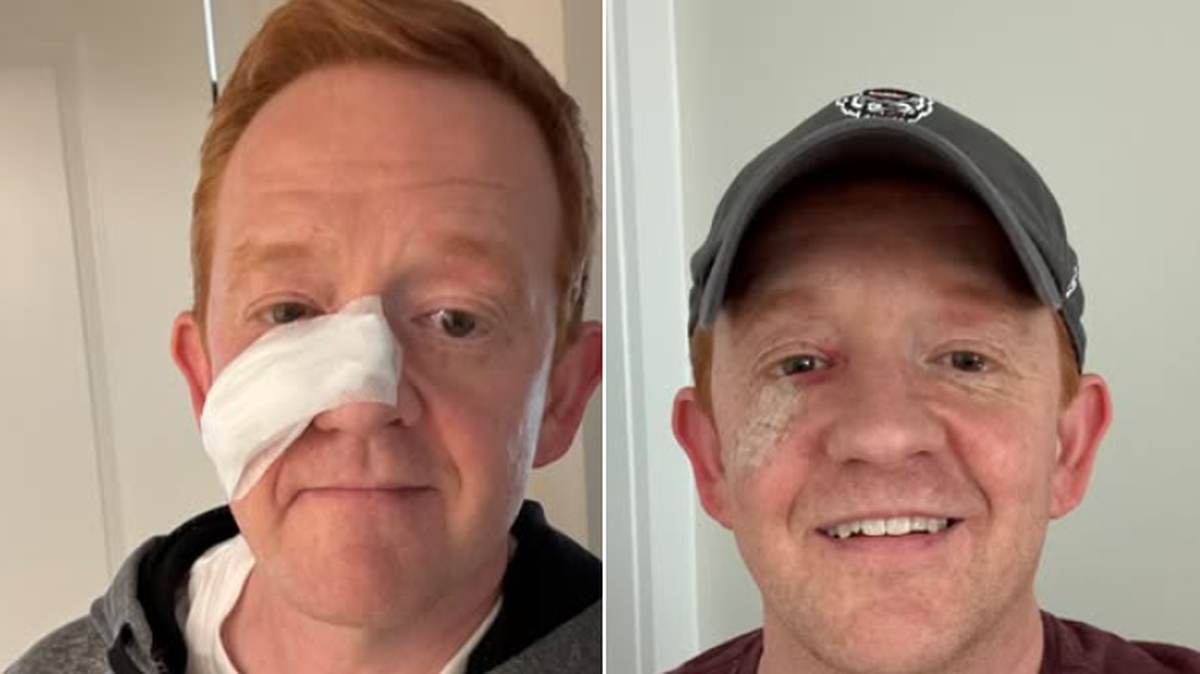 Meteorologist Lee Ringer took a break from on-air reporting to recover from a recent surgery.
