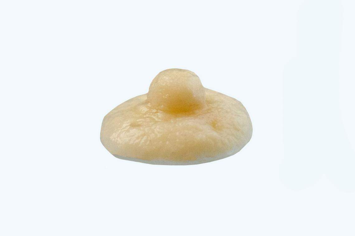 An example of an NAC Graft created by Durham-based BioAesthetics.