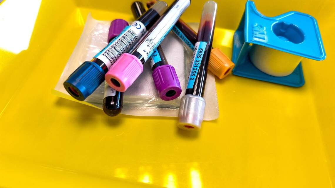 What’s next for Alzheimer’s blood tests? Experts predict the future of dementia detection