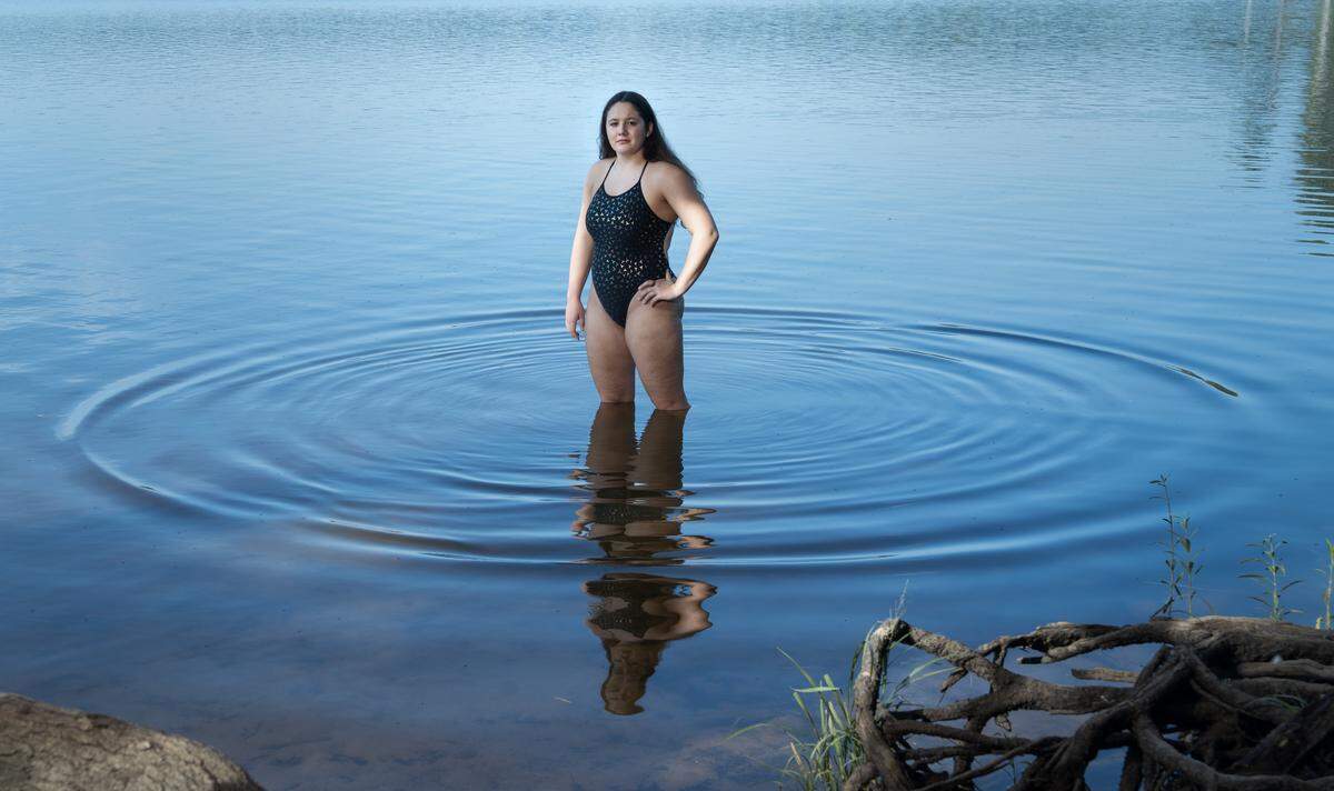 Lorelei Schmidt, 16, stands for a portrait on Tuesday, July 29, 2025 by Beaver Dam Lake near Durham, N.C., where she practices open water swimming.