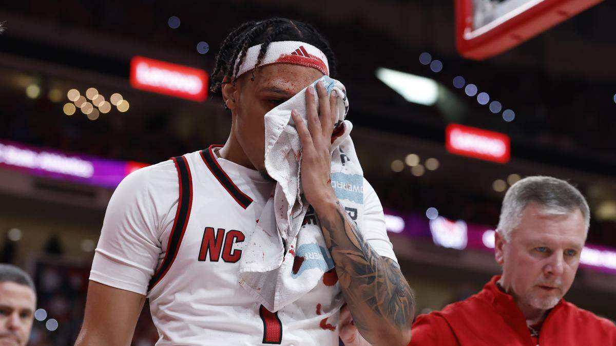 Darrion Williams exits N.C. State’s game against UNC with a bloody face in the first five minutes.