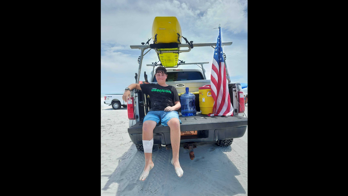 A teenager was bitten by what officials and doctors think was a shark off a North Carolina beach last week.