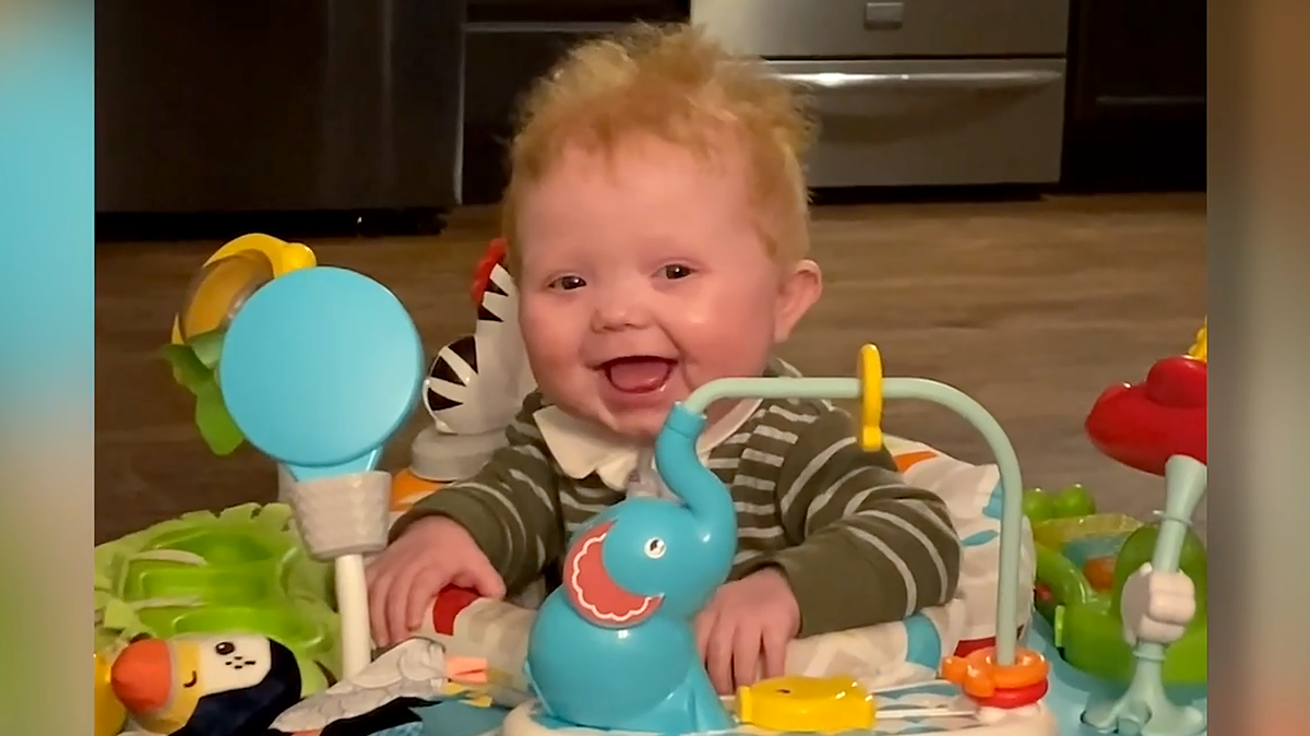 Easton Sinnamon at about the time of his first birthday. Six months earlier, Easton became the first person in the world to receive a transplanted heart and cultured thymus tissue from the same donor. Doctors at Duke Health say the procedure should help him tolerate the new organ, making the transplant more durable and successful.