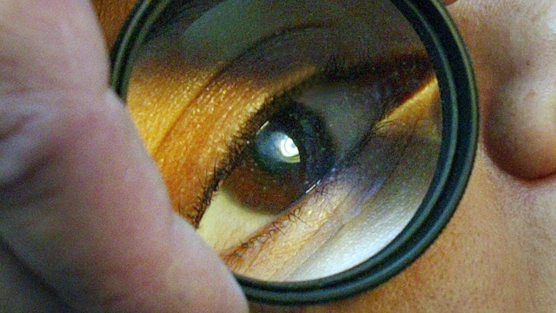 Eye scans could offer early warning signs of Alzheimer’s disease, Duke researchers find