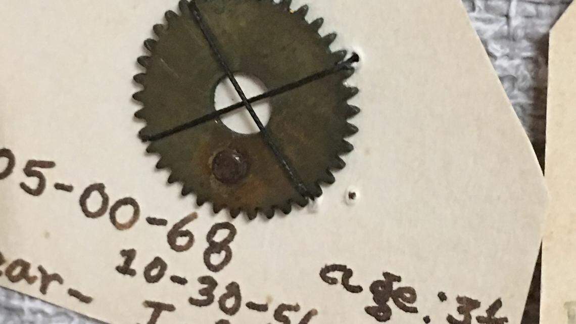 Car wash tokens, sardine can keys. These doctors extract weird stuff from people's bodies.