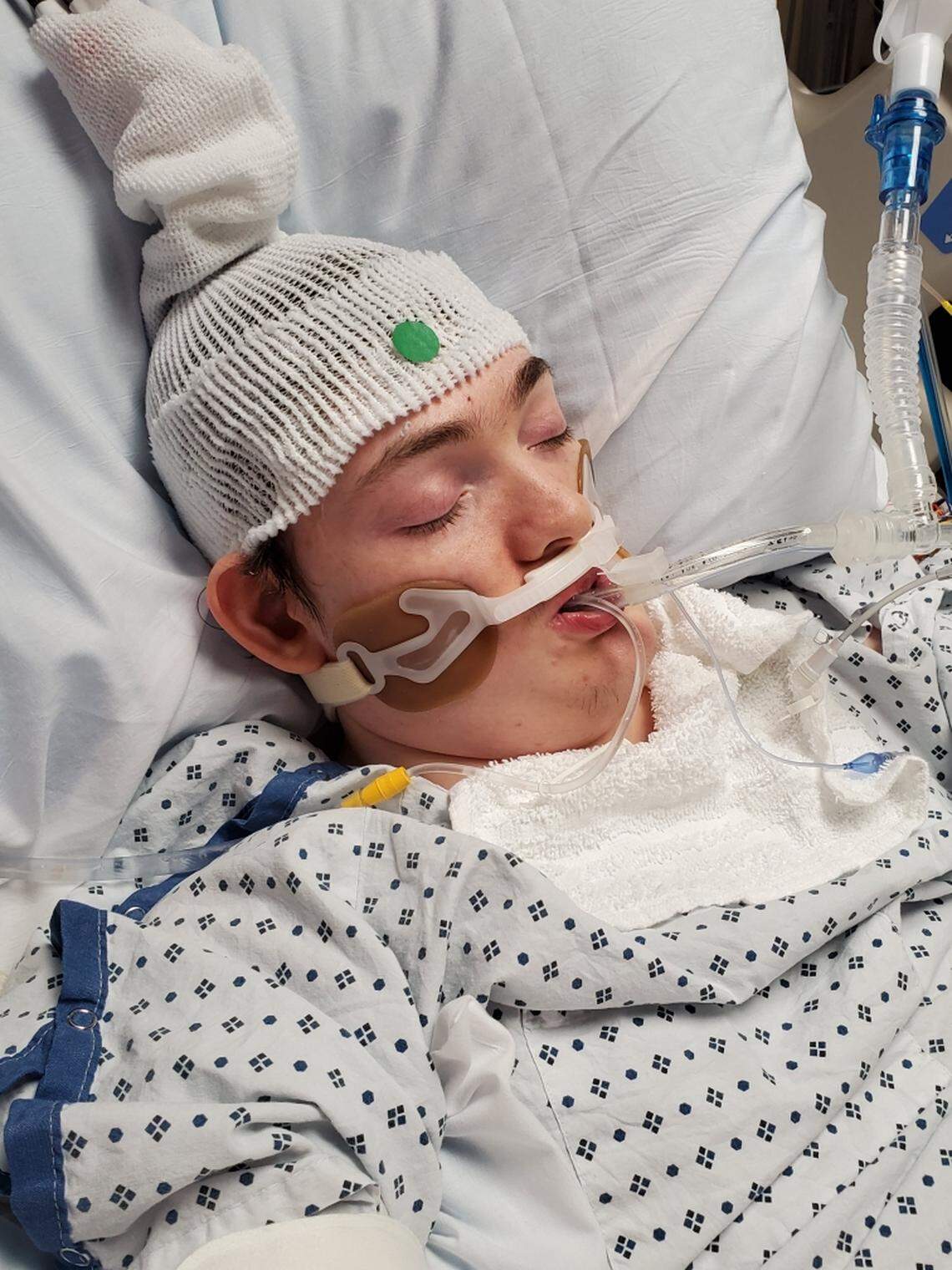 Lane Pegram, 21, in his hospital room in the neurology ICU at UNC Hospitals. Lane has FoxG1 syndrome, a rare rare neurological condition that causes intellectual disability, involuntary movements, and seizures. He was having seizures two weeks ago when he was first brought into Maria Parham Health in Henderson, N.C.