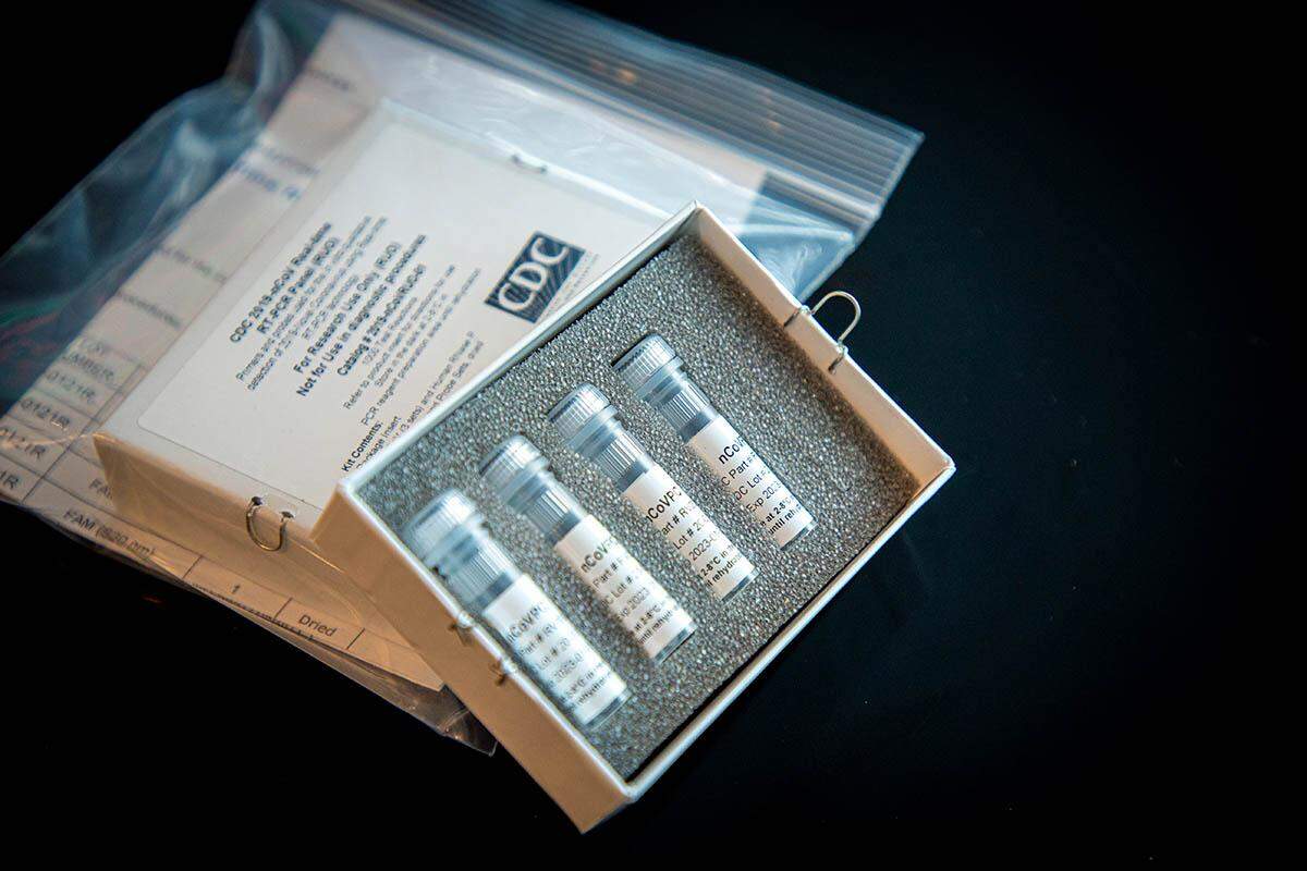 The CDC’s test kit for coronavirus.