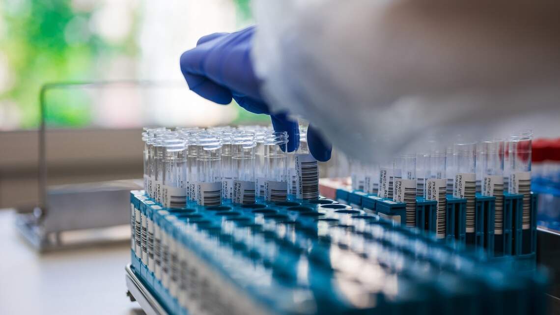 What is subscription biomarker testing? A 2026 guide to what preventive health memberships cost and measure