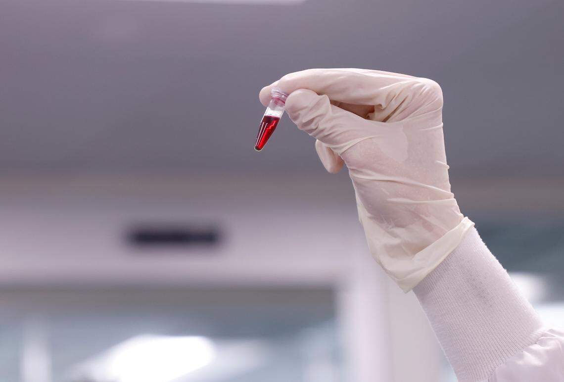 Jack Wilkinson, director of discovery at Elo Life Systems, examines a vial containing extract from watermelons to be evaluated for the production of high-potency sweetener on Wednesday, March 8, 2023, in Durham, N.C. The company puts the DNA of monk fruit into other plant cells to create a high-potency sweetener.