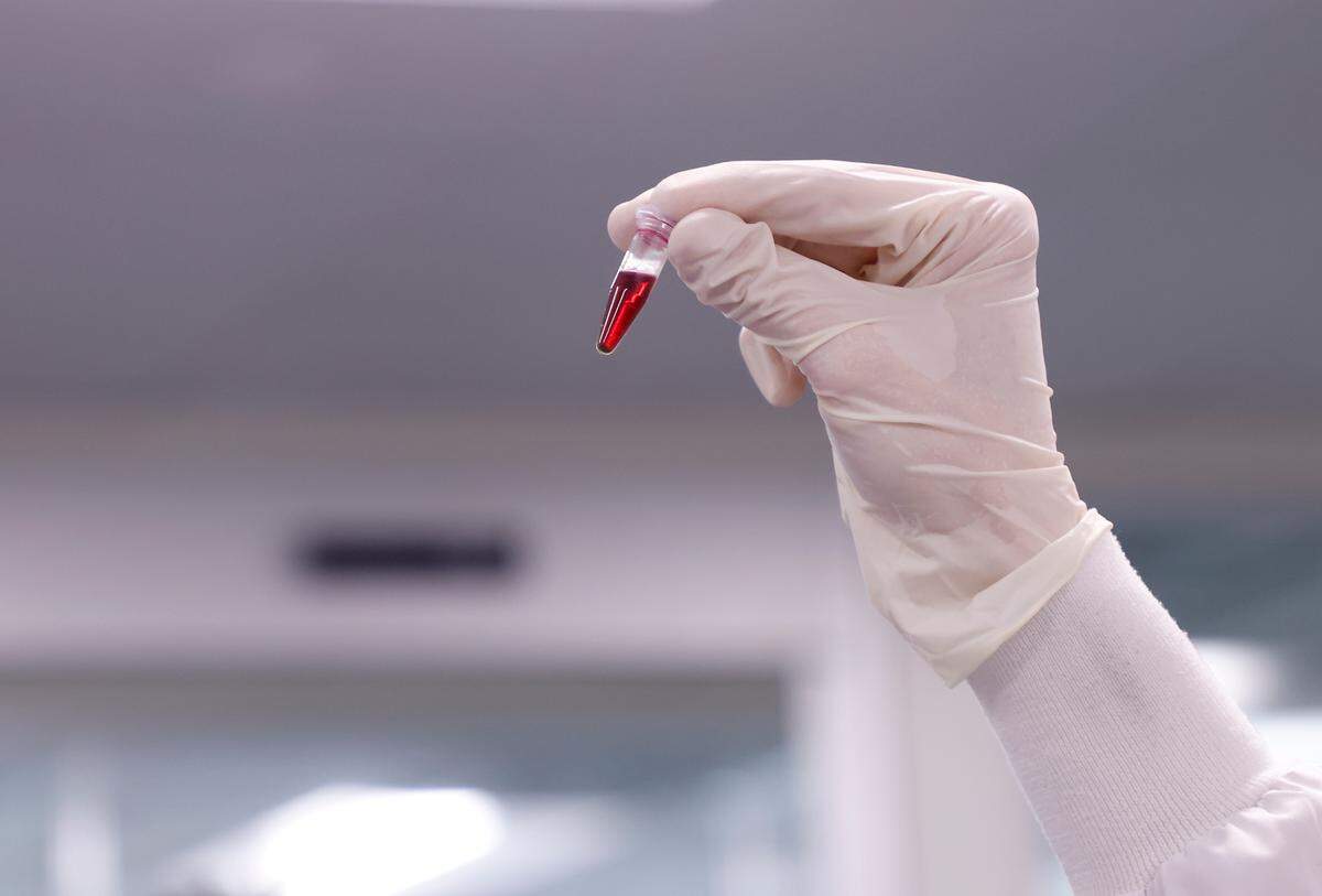 Jack Wilkinson, director of discovery at Elo Life Systems, examines a vial containing extract from watermelons to be evaluated for the production of high-potency sweetener on Wednesday, March 8, 2023, in Durham, N.C. The company puts the DNA of monk fruit into other plant cells to create a high-potency sweetener.