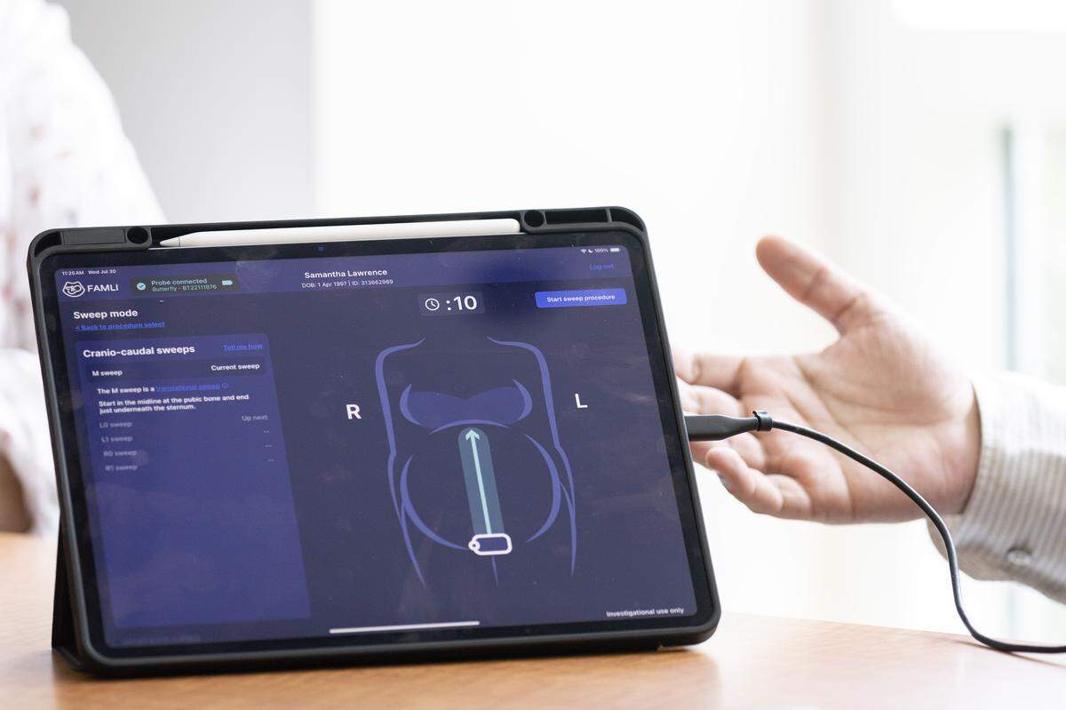 Dr. Jeffrey Stringer explains how a portable ultrasound device could make ultrasounds more accessible during an interview on Wednesday, July 30, 2025.
