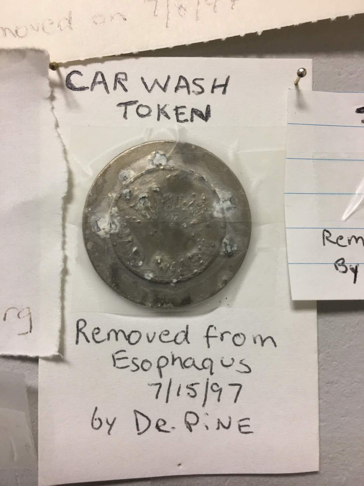 Since 1954, doctors at UNC Hospitals' ear, nose and throat department have collected foreign objects extracted from patients' facial cavities, including this car wash token taken from an esophagus in 1997. Many of the medical emergencies stem from children swallowing small objects, but adults' mishaps are well-represented in the extensive display.