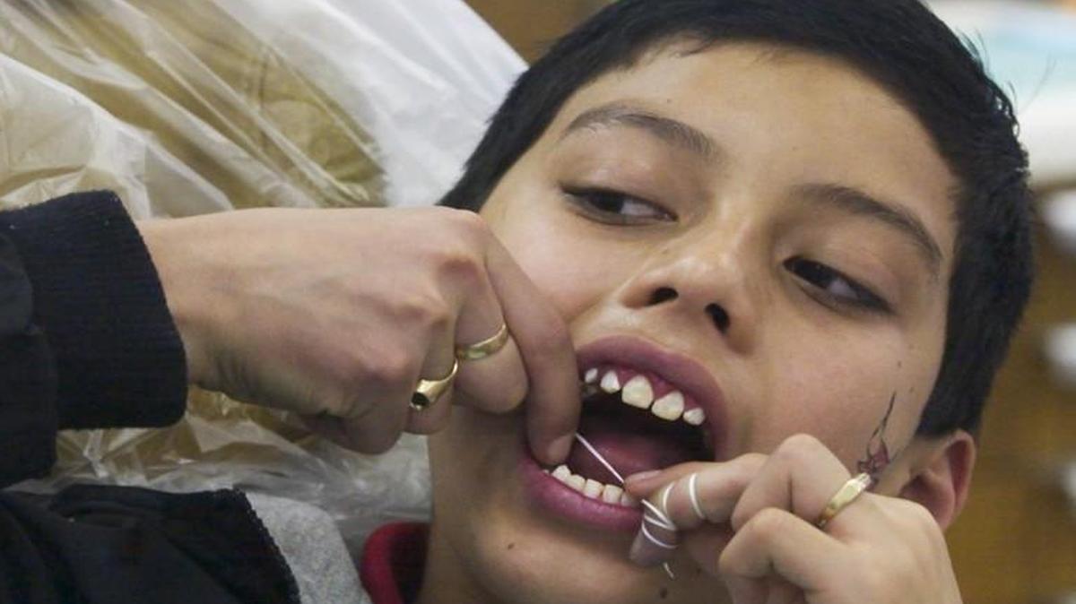 school-aged children are particularly affected by poor oral health.
