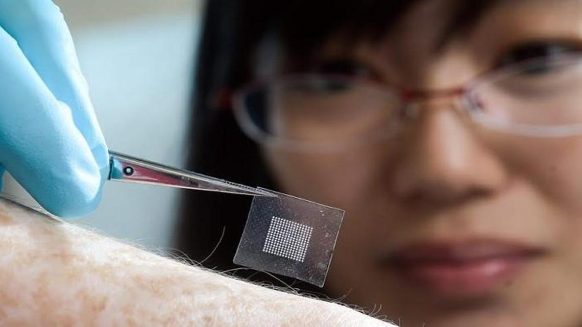 Glucose-responsive “smart insulin patches” like this one developed by UNC and N.C. State could one day simplify the way people manage diabetes.