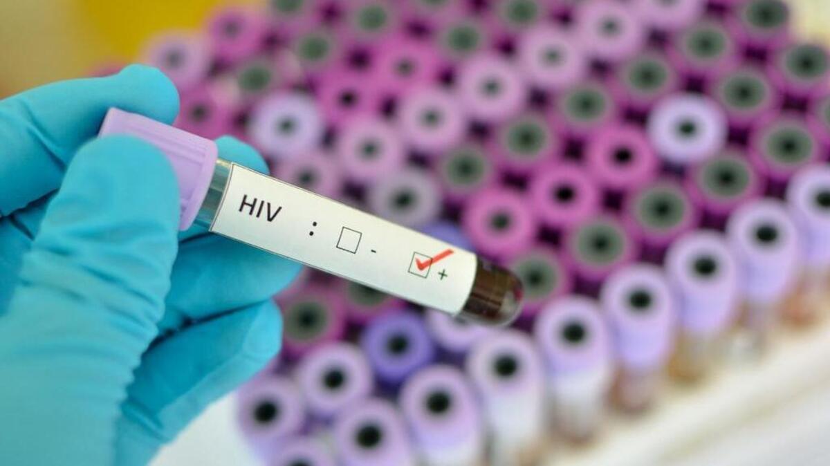 HIV has evolved into a master of avoiding immune system detection by undergoing spontaneous mutations that effectively make it a moving target.