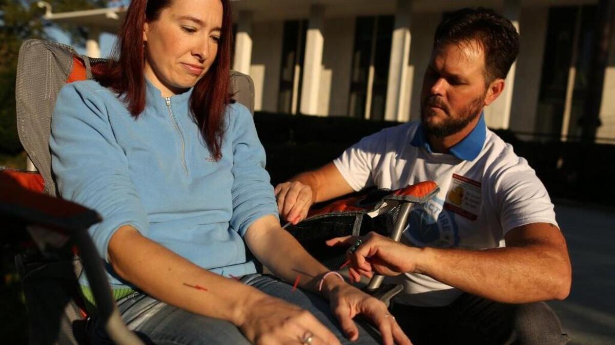 Morag MacLachlan, left, assists David Peters with an acupuncture demonstration in front of the Legislative Building in downtown Raleigh during the Walk for Acupuncture on Saturday, Oct. 29, 2016. The walk was hosted by the N.C. Association of Acupuncture and Oriental Medicine in an effort to increase awareness about the benefits of acupuncture.