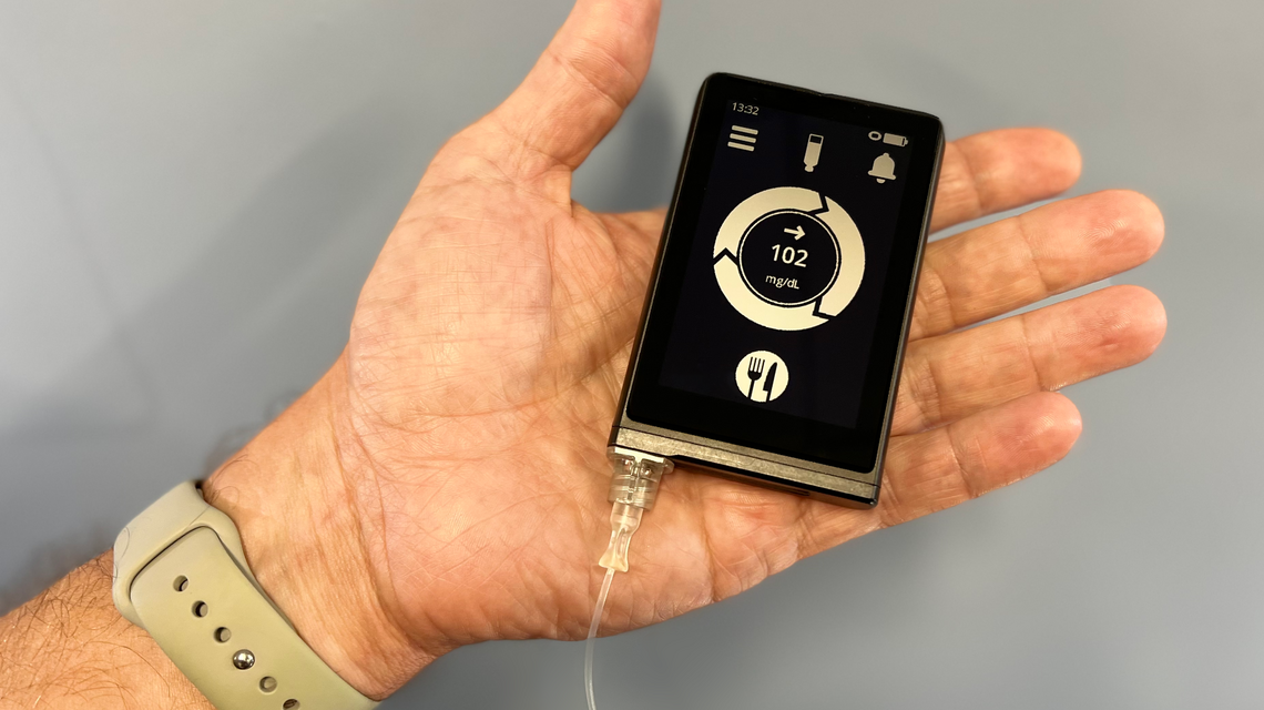 Bionic pancreas uses A.I. to inject insulin, makes type 1 diabetes easier to manage