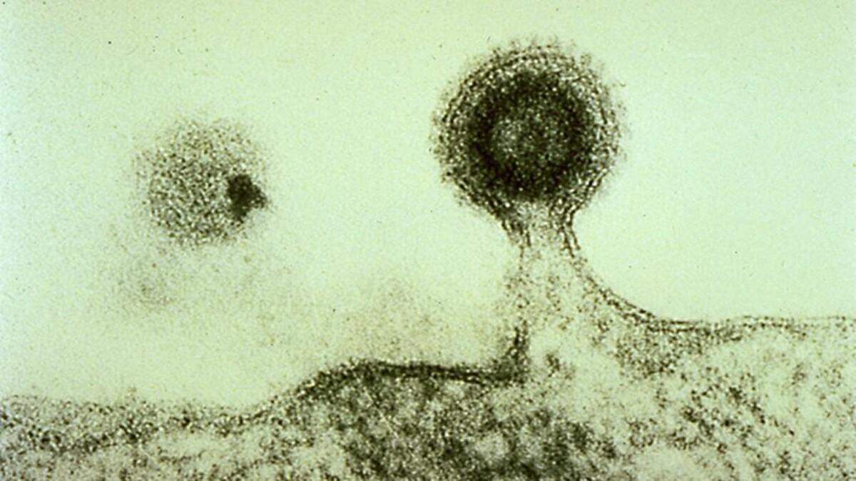 Electron micrograph of a new HIV particle budding on the surface of a cell (H.R. Gelderblom, Robert-Koch-Institut, Berlin) http://www.aids-info.ch/e_te/aas-e-imm.htm